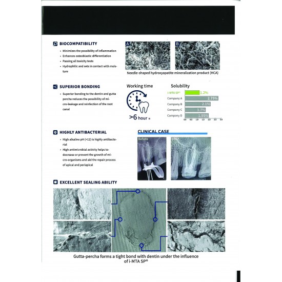 i-MTA SP Root Canal Sealer 